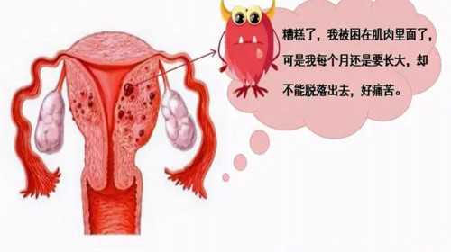 怎么买卵子[广州金贝供卵试管],鄂州先天性子宫内膜薄能做试管婴儿吗？