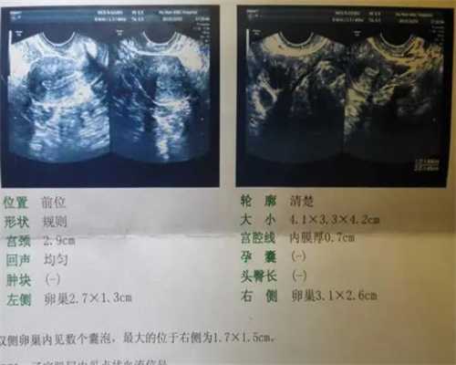广州代孕包儿子,	麦肯锡健康：美国试管的雷区：免费问诊&医生全程跟诊_上海