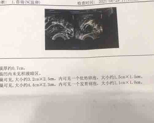 广州传承生殖医学供卵[3万找私人代孕],原济南铁路中心医院做试管怎么样