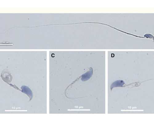 备孕期间梦见自己蒸包子,是身体反应还是心理因素?预示着什么好事?
