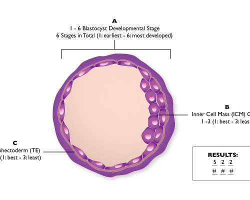 广州龙凤胎代孕套餐,子宫后位对美国试管婴儿胚胎移植有影响吗？_供卵中介合