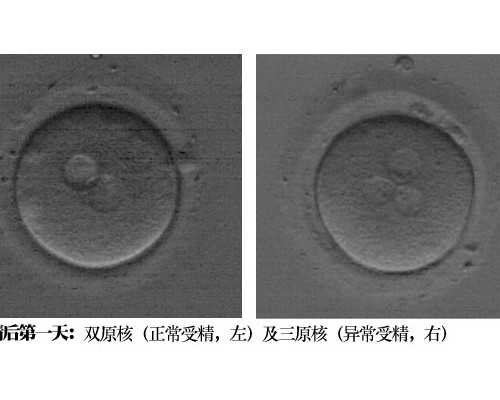 广州做供卵试管被骗的全过程,广州供卵包成功_代孕公司案例