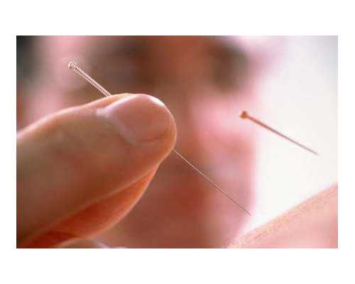 广州供卵一般需要多少钱呢 广州供卵试管费用 ‘唐筛看男女对照表’